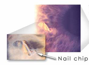 Nail Chip